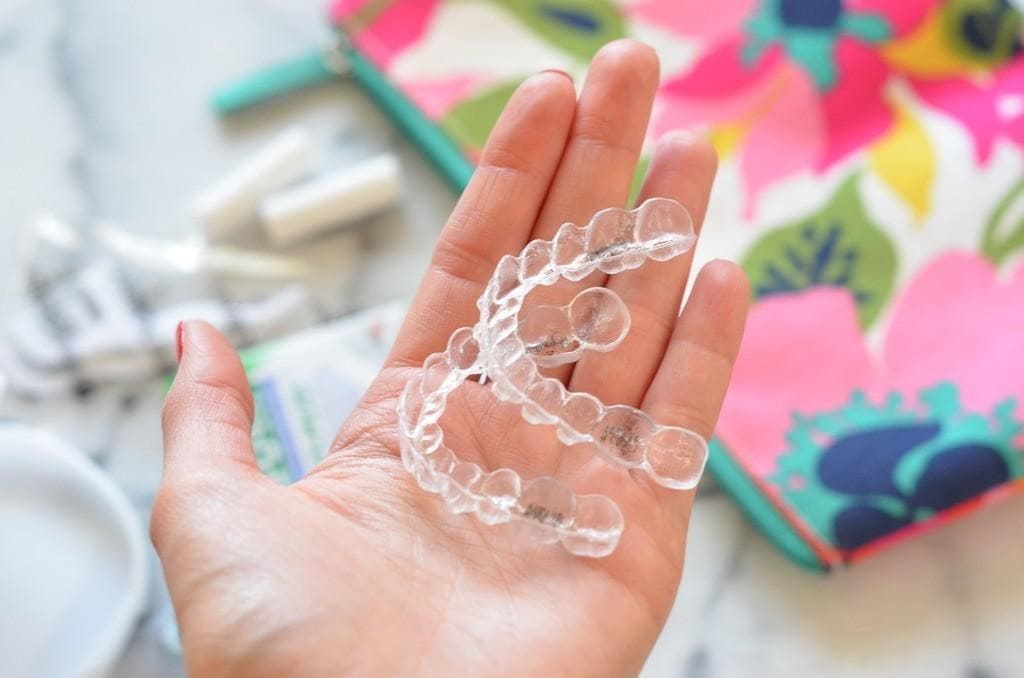 First Week Of Having Invisalign - Los Angeles, CA