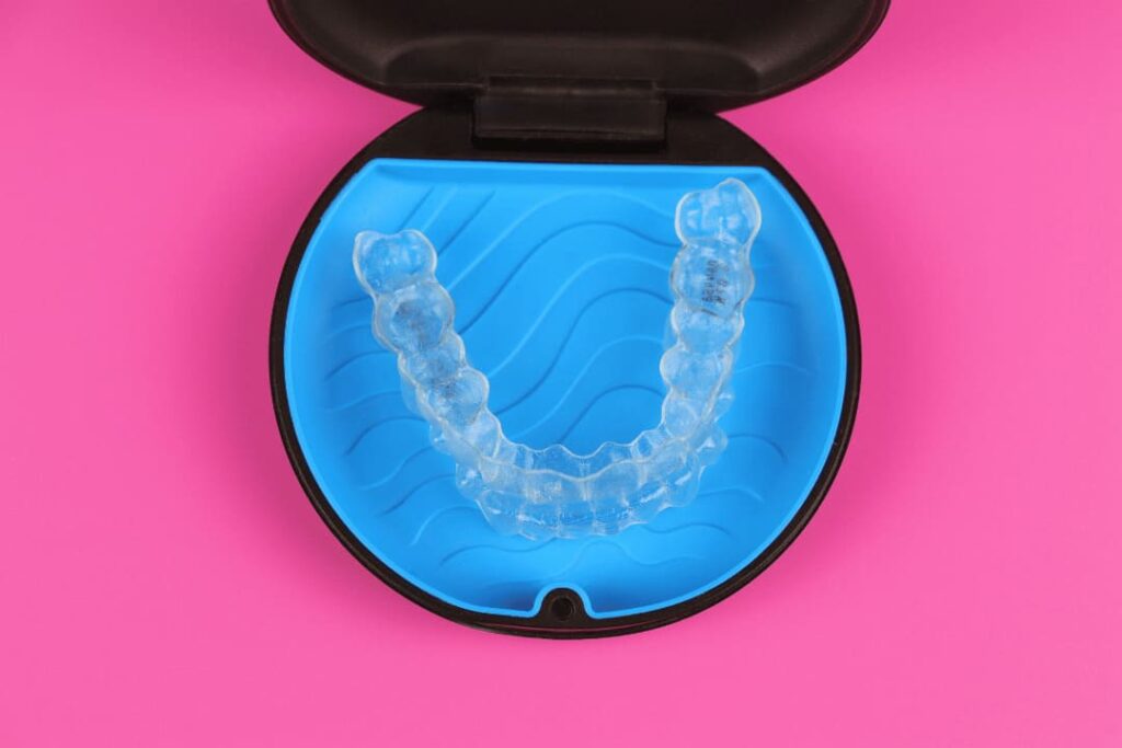 removable invisible braces