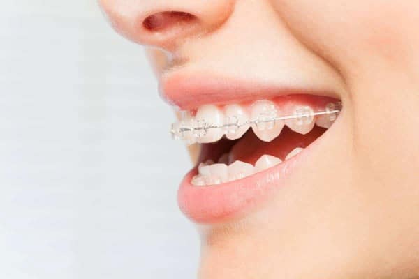 best orthodontist in LA