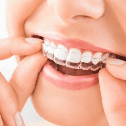 invisalign westwood​