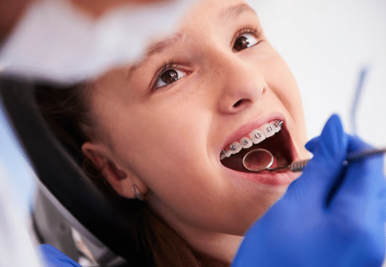 invisalign in beverly hills​