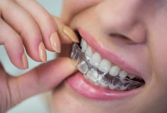 orthodontists in beverly hills​