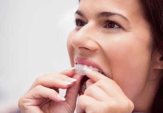 Invisalign in Westwood